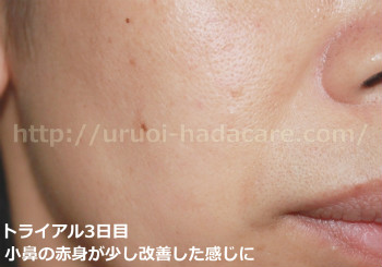 基礎化粧品を変えるとすぐに嬉しい変化 小鼻の赤み改善